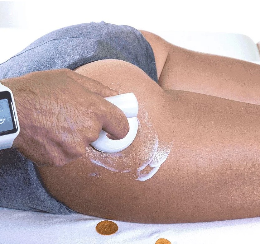 Fisioestetica_cura cellulite_FORMA Poliambulatorio