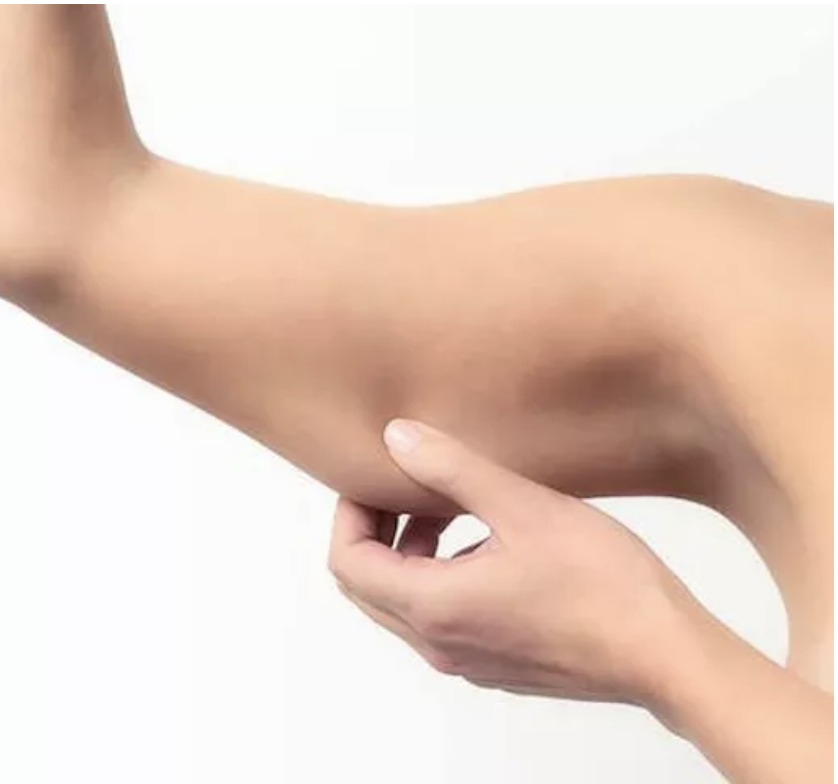 Radiofrequenza rassodante_FORMA Poliambulatorio Riabilitativo